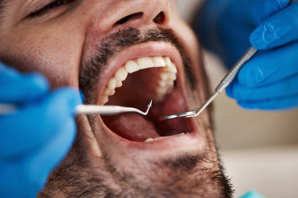 Best 24-Hour Emergency Dentist in Broadmoor, CA